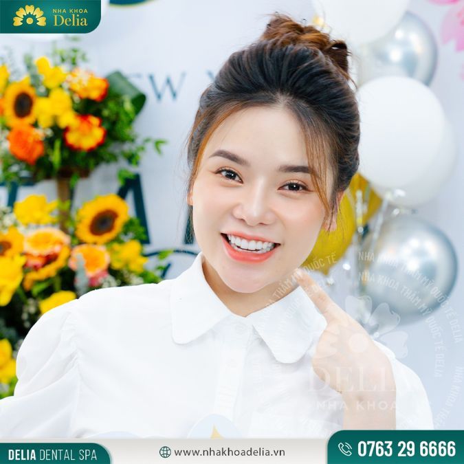 Bọc răng sứ - Chỉnh răng móm nhẹ