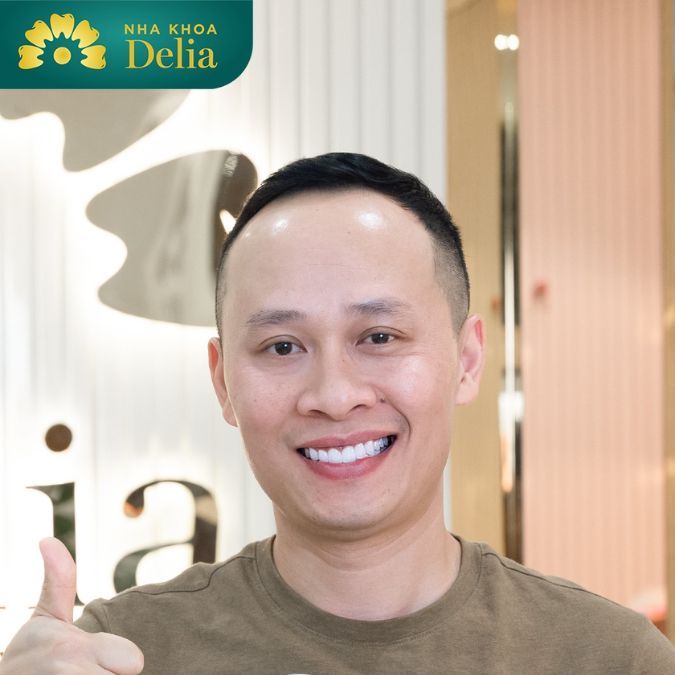 Tập cười đẹp cho nam mỗi ngày ở trước gương