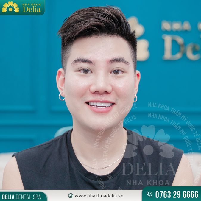 Sở hữu nụ cười đẹp bằng cách luyện tập biểu cảm khuôn mặt