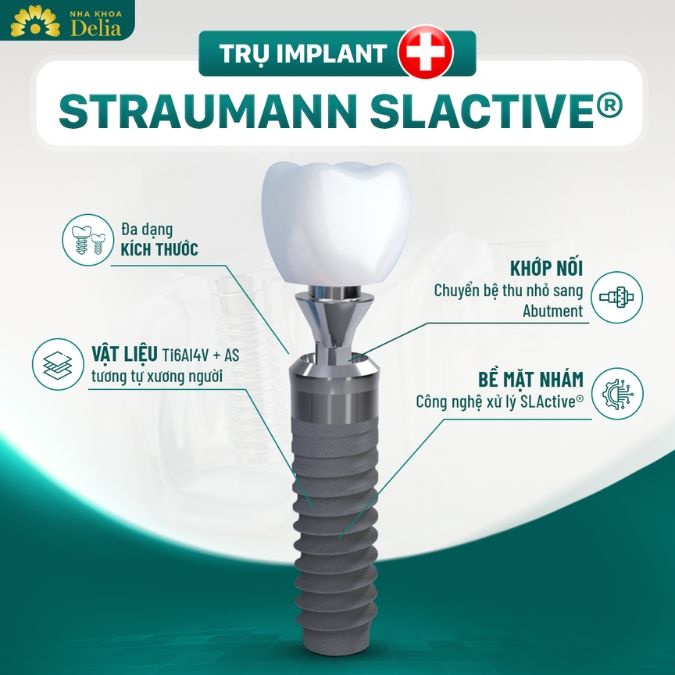 Cơ sở vật chất chuyên biệt cho dịch vụ cấy ghép Implant