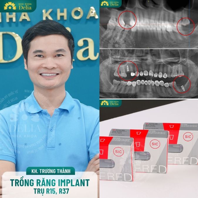 Case khách hàng thành công thực tế tại nha khoa Delia