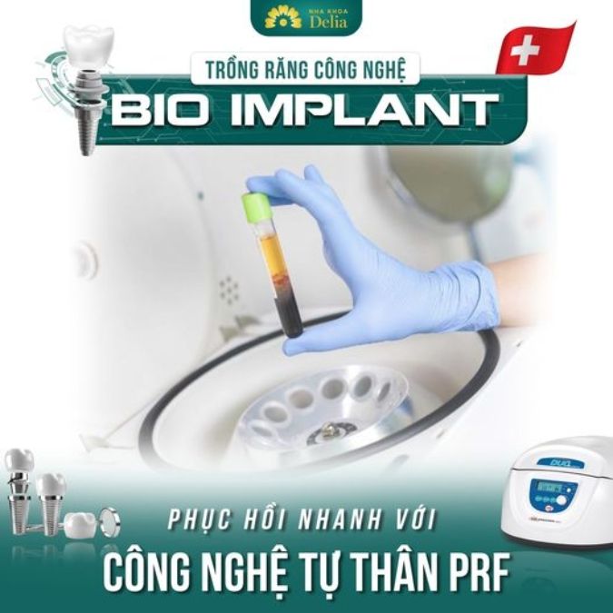 Cơ sở vật chất chuyên biệt cho dịch vụ cấy ghép Implant
