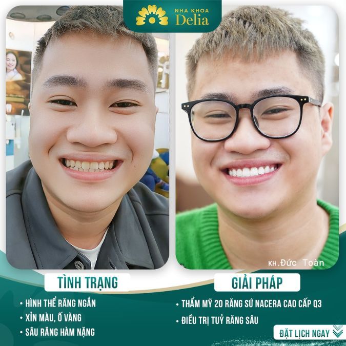 Anh Toàn với nụ cười 10 điểm