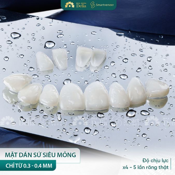 Sứ càng cao cấp đương nhiên giá cả sẽ đắt đi kèm với đó là độ bền cao, màu sắc tự nhiên trắng đẹp hơ