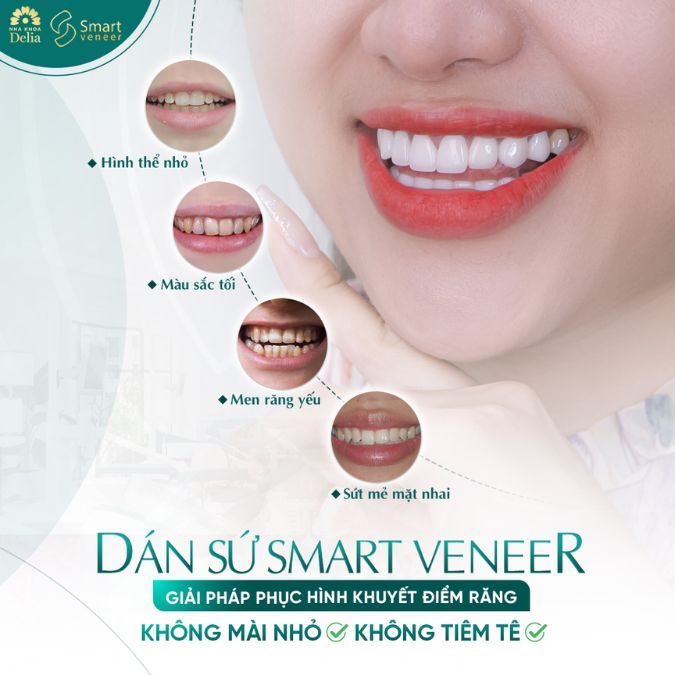 Với miếng dán sứ, những khuyết điểm trên răng sẽ được che đi một cách hoàn hảo