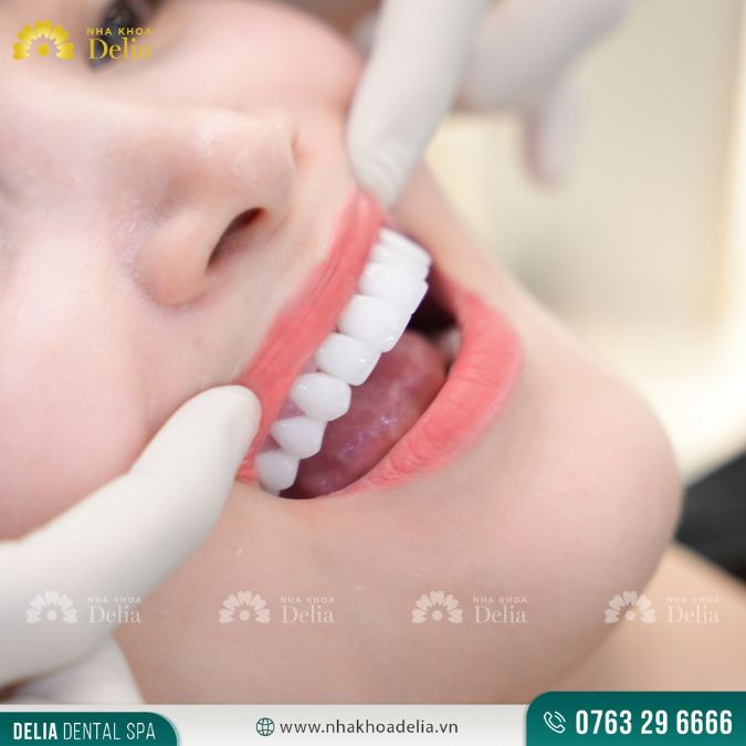 High quality porcelain teeth, imported from America, Germany, etc.