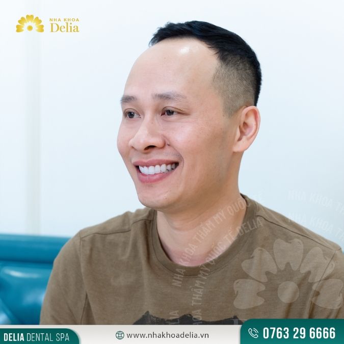Chăm sóc răng đúng cách sau cấy ghép Implant
