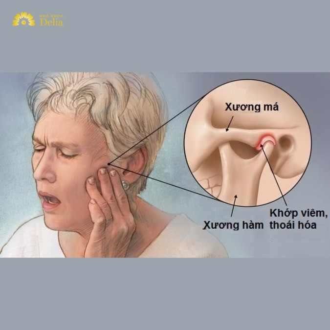 Mất răng hàm có thể gây ra những ảnh hưởng gì? 