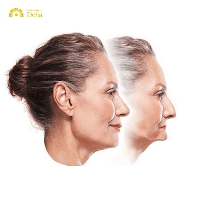 Nhổ răng cửa xong không trồng lại có sao không?