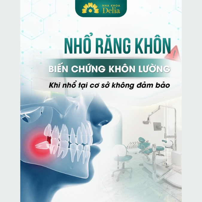 Nhổ răng khôn có bị tiêu xương không?