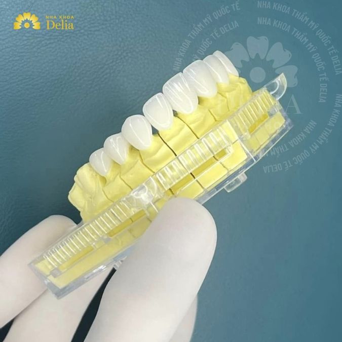 Phục hình răng sứ trên Implant để làm gì? Có cần thiết không?