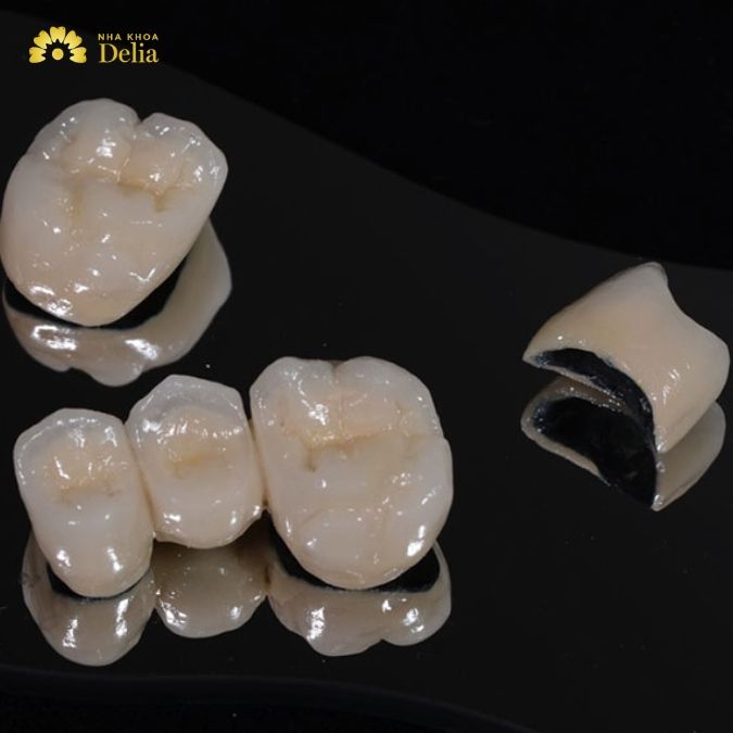Nên sử dụng dòng sứ nào để phục hình trên Implant?