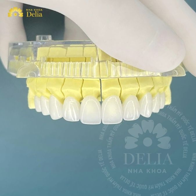 Nên sử dụng dòng sứ nào để phục hình trên Implant?