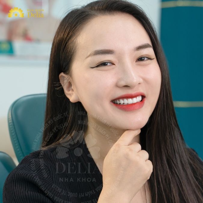 Nên sử dụng dòng sứ nào để phục hình trên Implant?