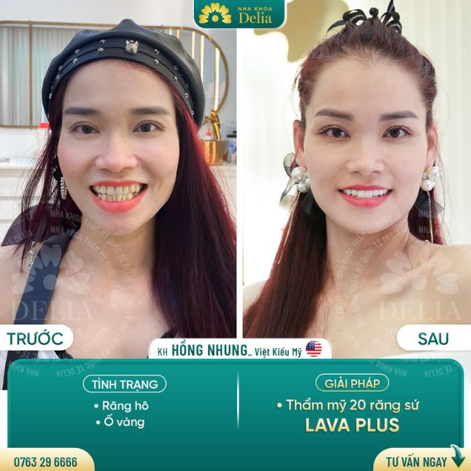Customer Hong Nhung