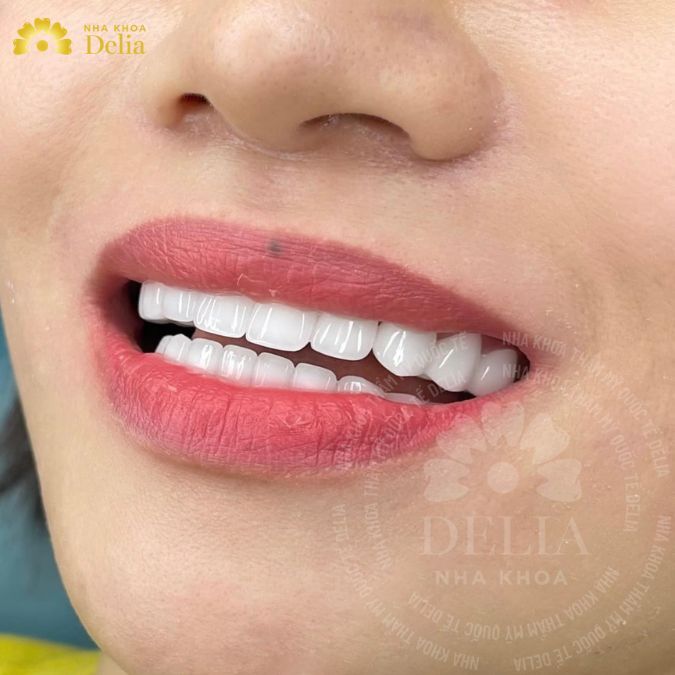 Sử dụng hàm không có răng bị vỡ để nhai thức ăn