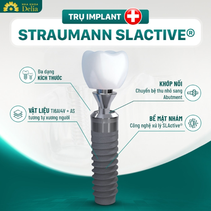 Công nghệ Bio Implant độc quyền tại nha khoa Delia