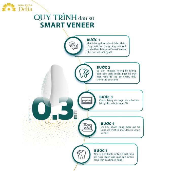 Dán sứ Smart Veneer cũng giống như dán sứ thông thường cần phải trải qua 5 bước