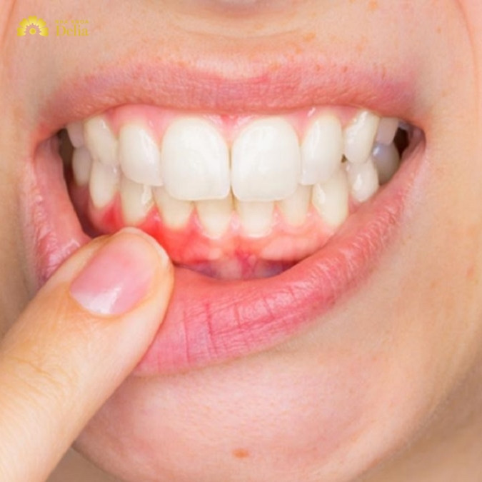 Các triệu chứng bất thường sau cấy Implant không nên coi thường 