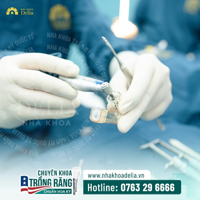 20+ Địa chỉ trồng răng Implant Đà Nẵng chất lượng cao