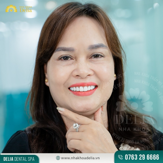 13+ Địa chỉ trồng răng Implant tại Thanh Hóa uy tín, chất lượng quốc tế