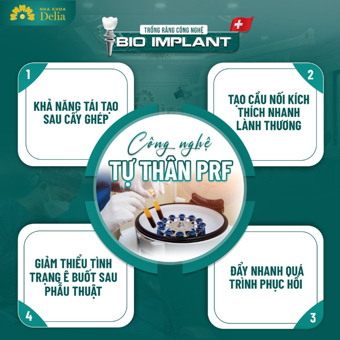 13+ Địa chỉ trồng răng Implant tại Thanh Hóa uy tín, chất lượng quốc tế