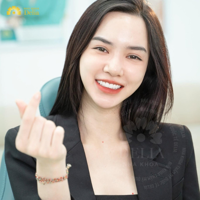 13+ Địa chỉ trồng răng Implant tại Thanh Hóa uy tín, chất lượng quốc tế