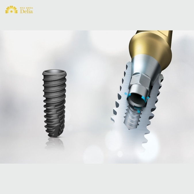 Trụ Implant Osstem có những đặc điểm gì đáng chú ý? 
