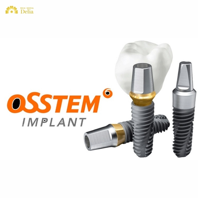 So sánh trụ Implant Osstem với trụ Dio Hàn Quốc