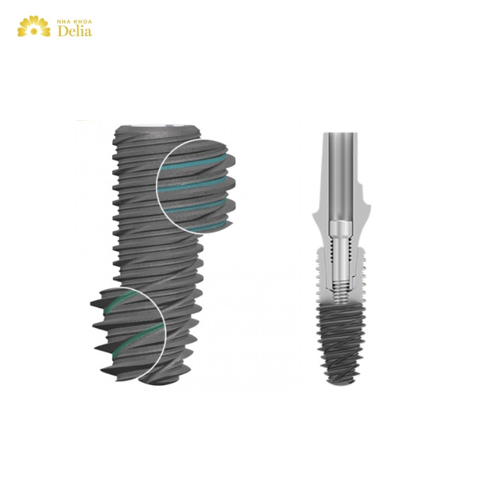 Top 6 dòng trụ Implant Pháp chất lượng cao hiện nay 