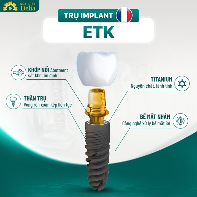 Trụ Implant Pháp là gì? 