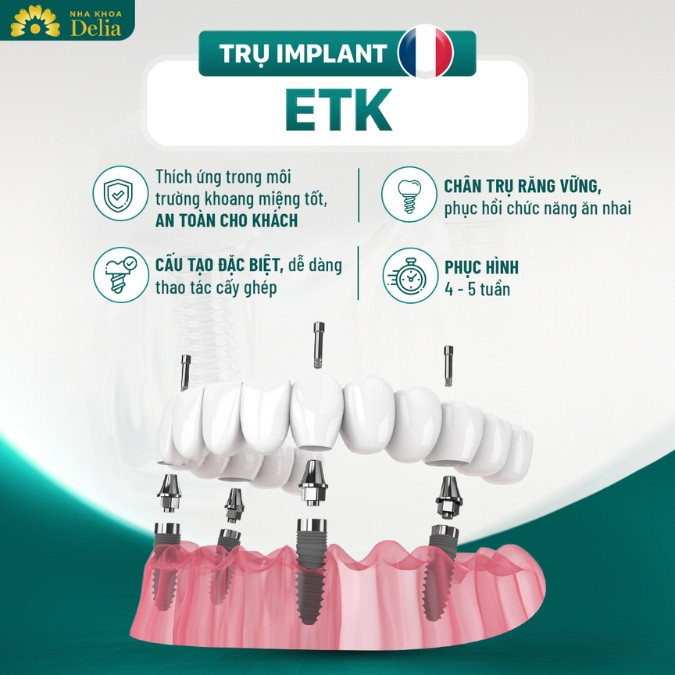 Đặc điểm của trụ Implant Pháp 