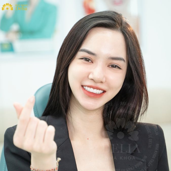 Emax Veneer có độ trong mờ, khả năng khuếch tán ánh sáng cực kỳ hiệu quả