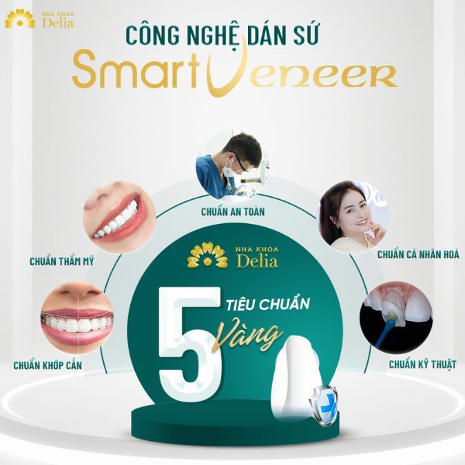 Tuổi thọ miếng dán sứ cao