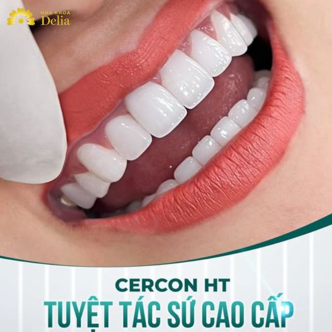 Răng sứ Cercon HT - Cải thiện tình trạng răng cửa hô cho chị Huế Bạch