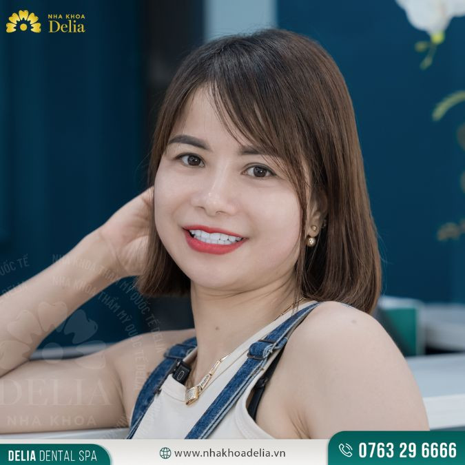 Bọc răng sứ thức tỉnh nụ cười hoàn mỹ khi chụp ảnh