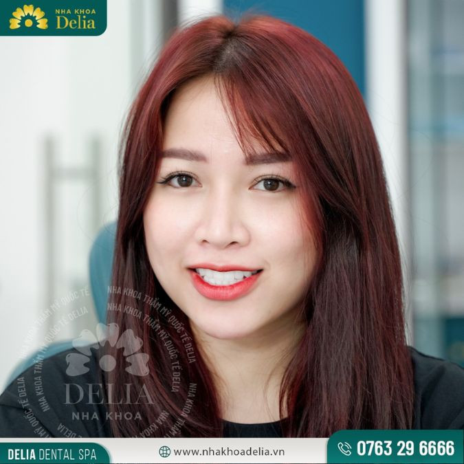 Khách hàng với nụ cười trắng sáng