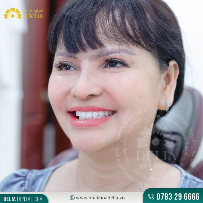 Phương pháp mài cùi răng cửa được đánh giá là nhanh chóng