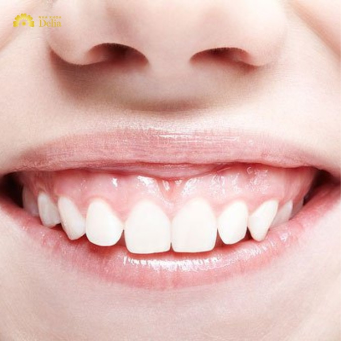 Mài xương ổ răng có gây ảnh hưởng xấu đến xương hàm không?