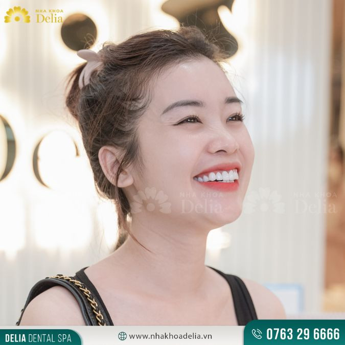 Một khuôn miệng đẹp là khi cười chỉ hở 8 - 10 cái răng