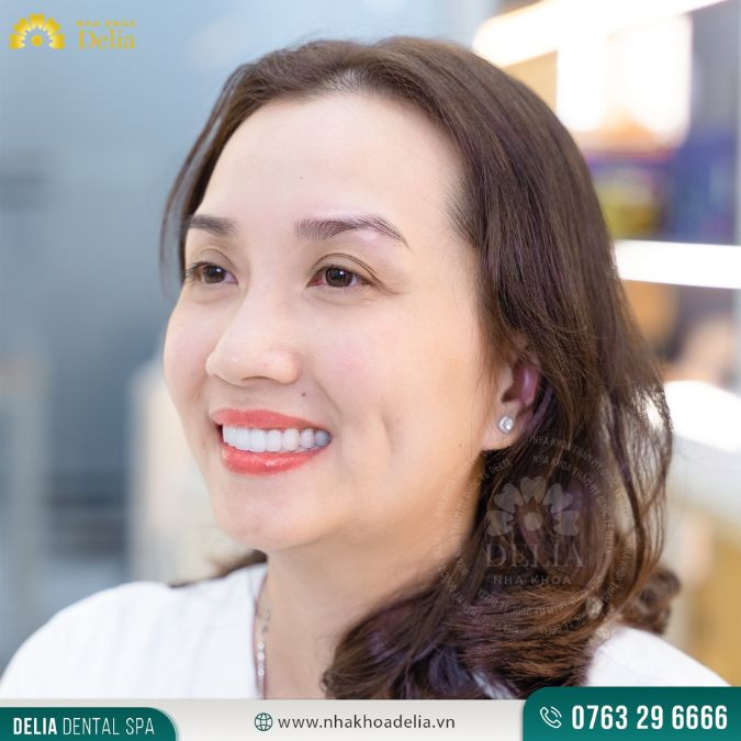 Một cách giúp bạn trở nên xinh đẹp và gây được thiện cảm tốt hơn trong mắt người khác chính là tập khóe miệng cười