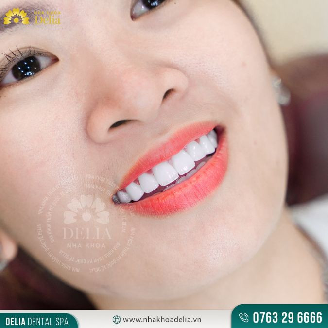 ếu như mắc phải một số bệnh lý liên quan đến nướu lợi thì khả năng răng cũng có thể nhỏ lại