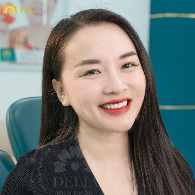 Răng sứ HT Smile là dòng răng sứ cao cấp được sản xuất bởi tập đoàn HC Starck tại CHLB Đức