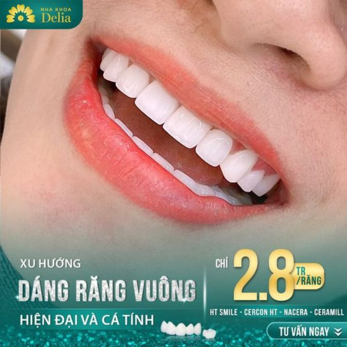 Dáng răng sứ vuông