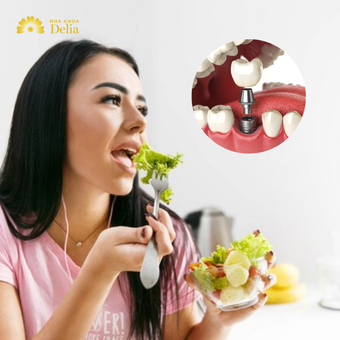 Trồng răng implant bao lâu thì ăn được?