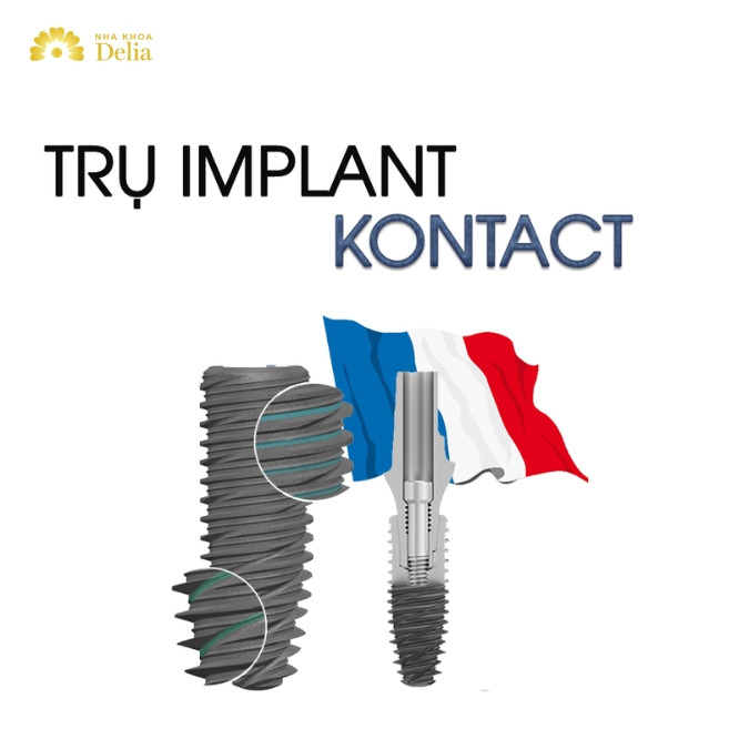 Thông tin chi tiết về trụ Implant Kontact 
