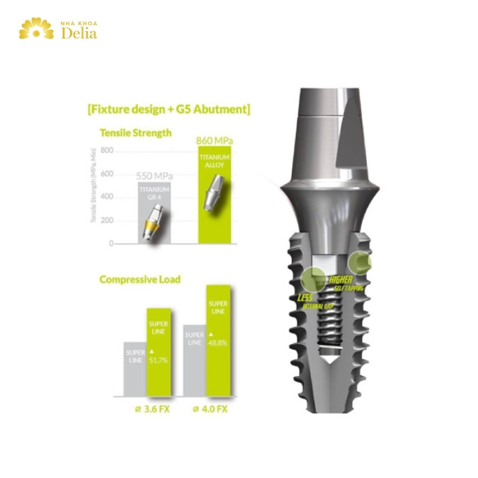 Trụ Implant Kontact có cấu tạo như thế nào?