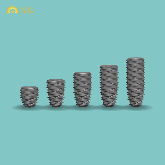 So sánh trụ Implant Tekka với trụ Implant Kontact Pháp 