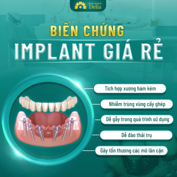 Hậu quả khôn lường khi sử dụng các dòng trụ Implant không rõ nguồn gốc 