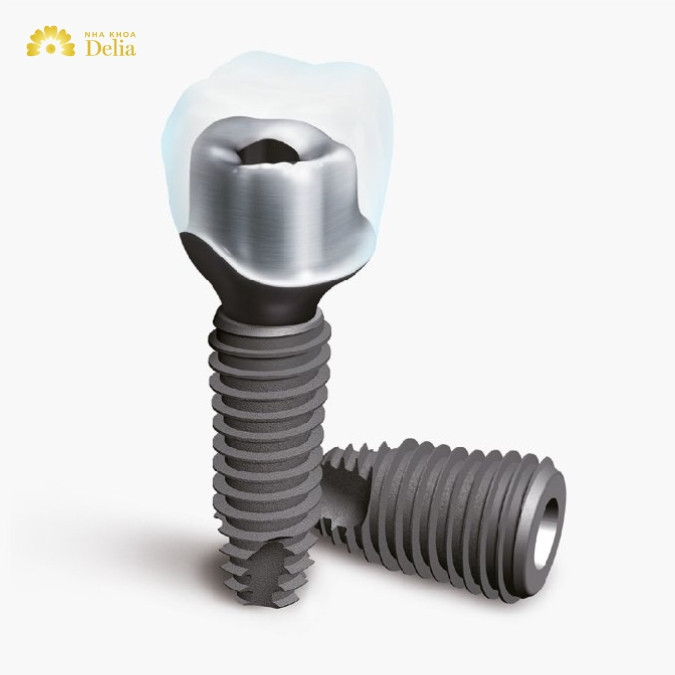 So sánh trụ Implant Megagen với trụ Dio Hàn Quốc 